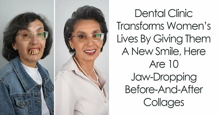 10 Jaw-Dropping Before-And-After Collages Of Women Who Underwent Extensive Smile Makeovers