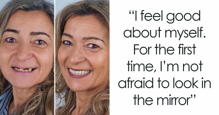 8 Jaw-Dropping Before-And-After Collages Of Women Who Underwent Extensive Smile Makeovers