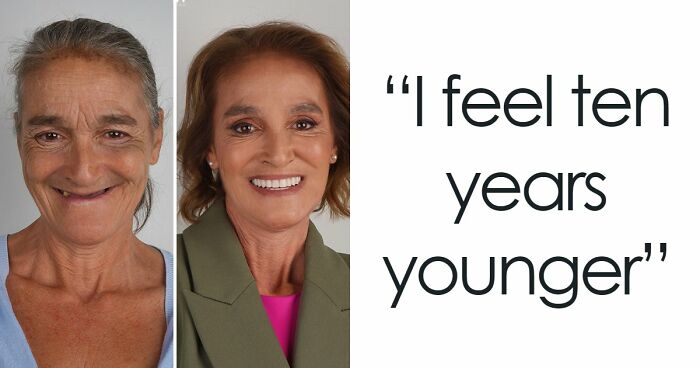 8 Jaw-Dropping Before-And-After Collages Of Women Who Underwent Extensive Smile Makeovers