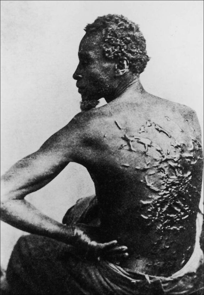 Historical photos: A man's back severely scarred from whipping, a powerful and impossible to explain image.