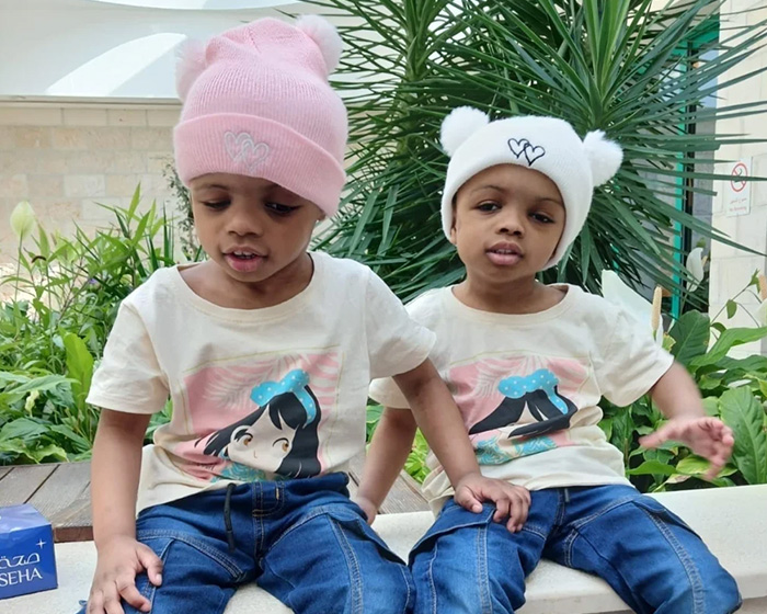 Smiling 2-year-old conjoined twins successfully separated post-surgery, wearing beanies and matching cartoon shirts. Smiling 2-year-old conjoined twins successfully separated post-surgery, wearing beanies and matching cartoon shirts.