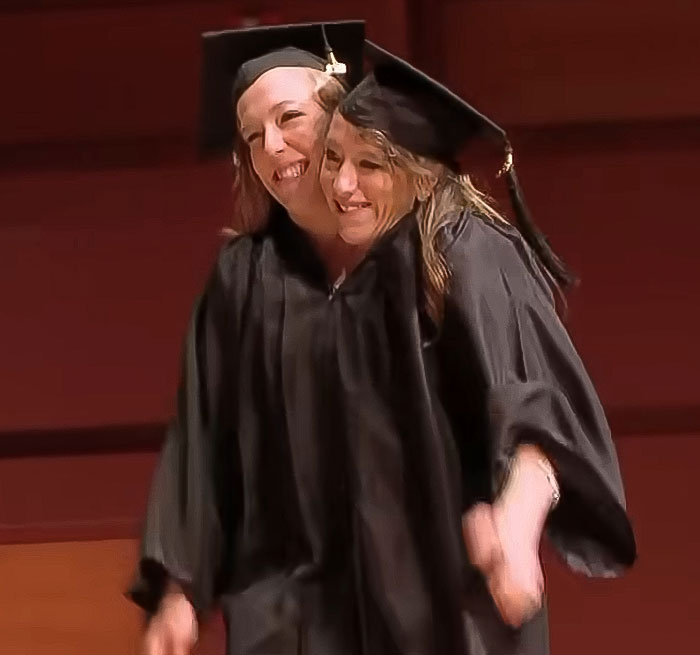 Conjoined twins successfully separated post-surgery, celebrating graduation in caps and gowns, smiling happily. Conjoined twins successfully separated post-surgery, celebrating graduation in caps and gowns, smiling happily.