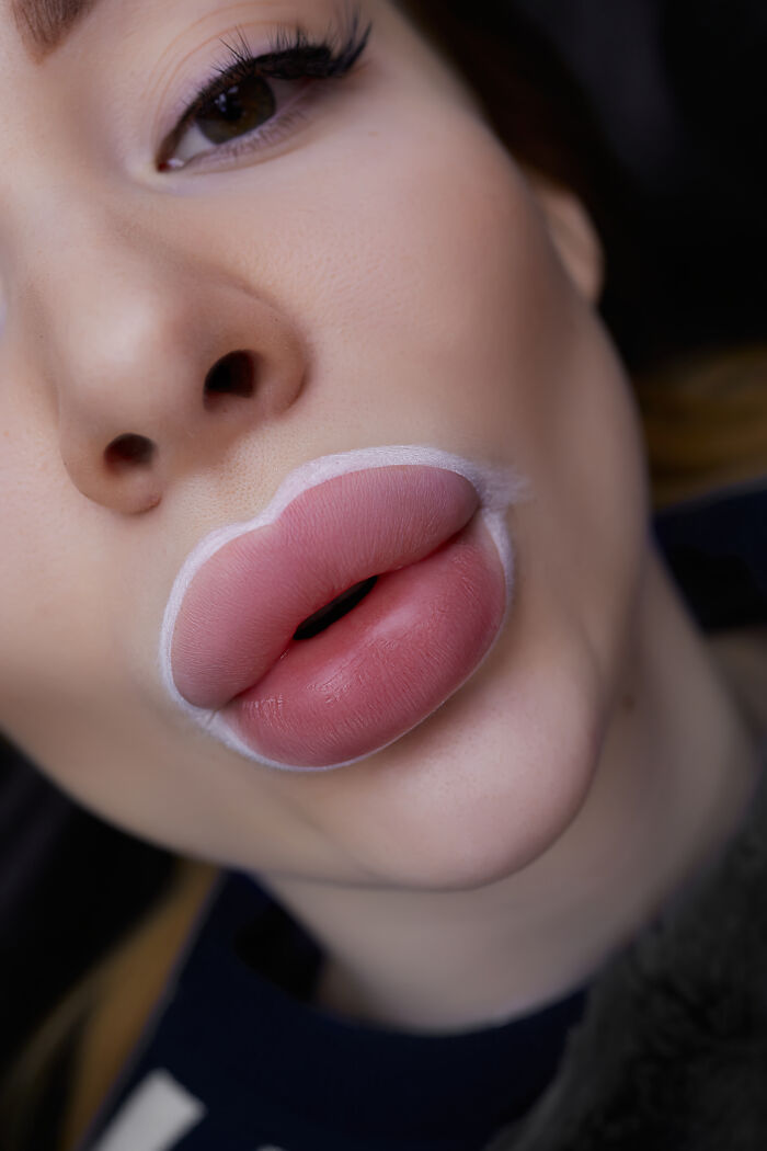 A close-up of a woman's lips with white outlining, preparing for a procedure, a potential turn off for some men.