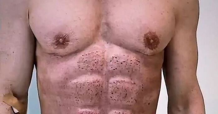 “Time For The Apocalypse”: Man Shows Off His Ab Implants And The Internet Is Collectively Shaking Its Head