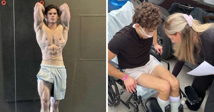 “Looksmaxxing” Influencer Clavicular Shares Nose Job, But All Fans Notice Is His Post-Hormone Transformation