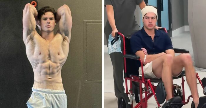 Looksmaxxer Clavicular Just Had His 3rd Surgery, And People Are Getting Concerned About His Transformation