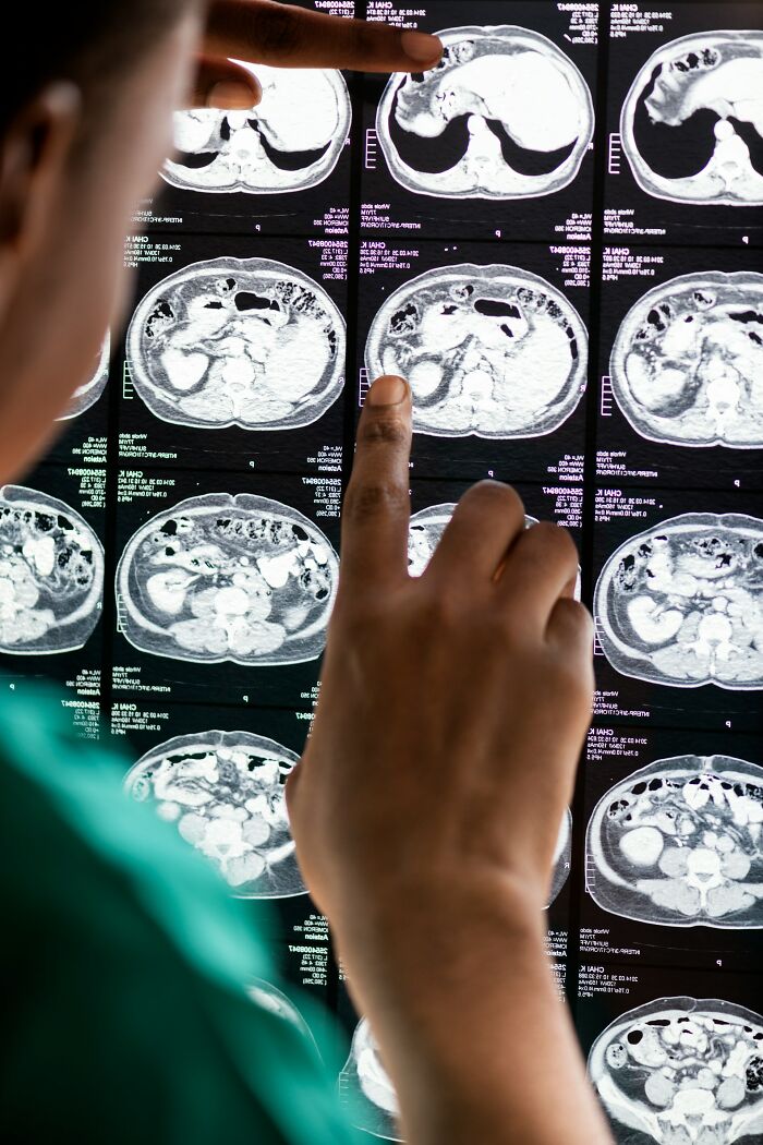 Doctor analyzing brain scans and human body facts