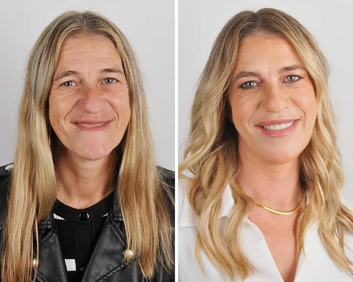Side-by-side smile makeover collage revealing brightened teeth and confident smile