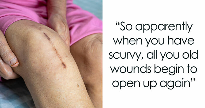 “Farts Of Bacteria”: 37 Human Body Facts That Make Existing Feel A Little More Uncomfortable
