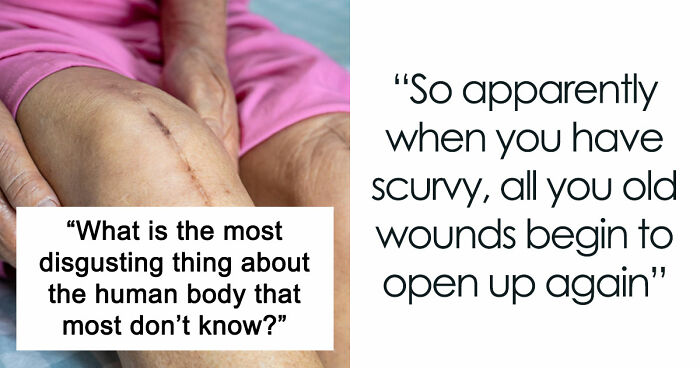 “Farts Of Bacteria”: 37 Human Body Facts That Make Existing Feel A Little More Uncomfortable