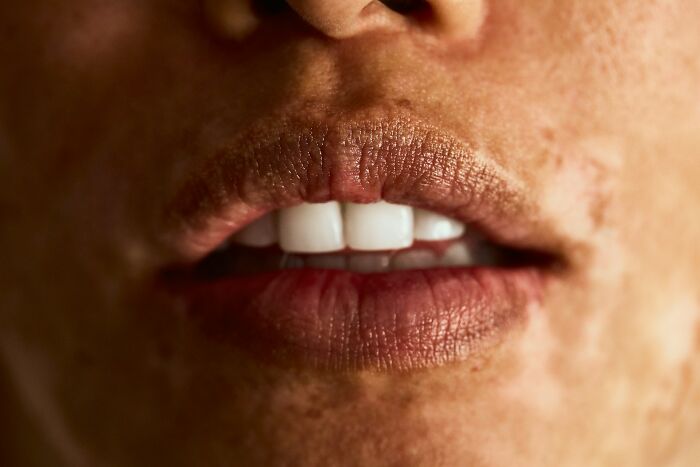 Close-up of lips and teeth showing dry skin texture, human body fact concept