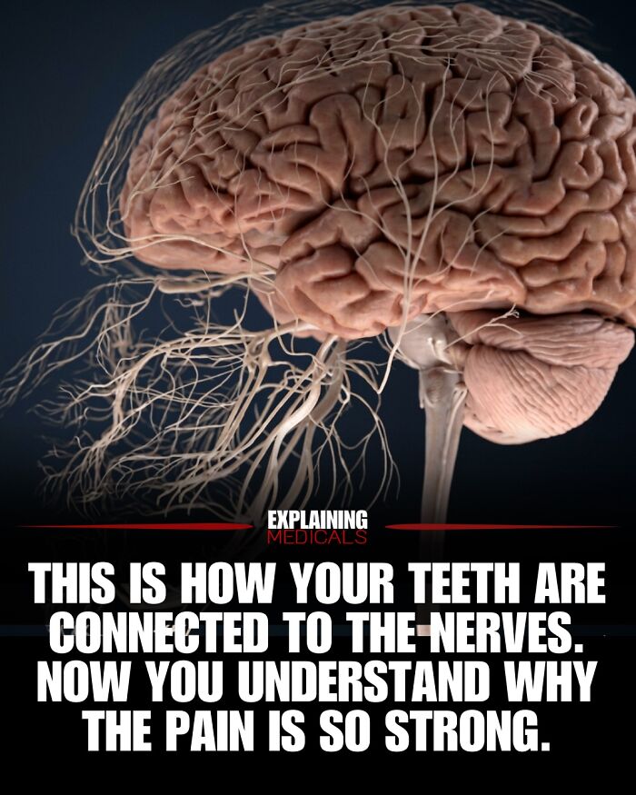 Human brain showing nerve connections explaining tooth pain sensitivity