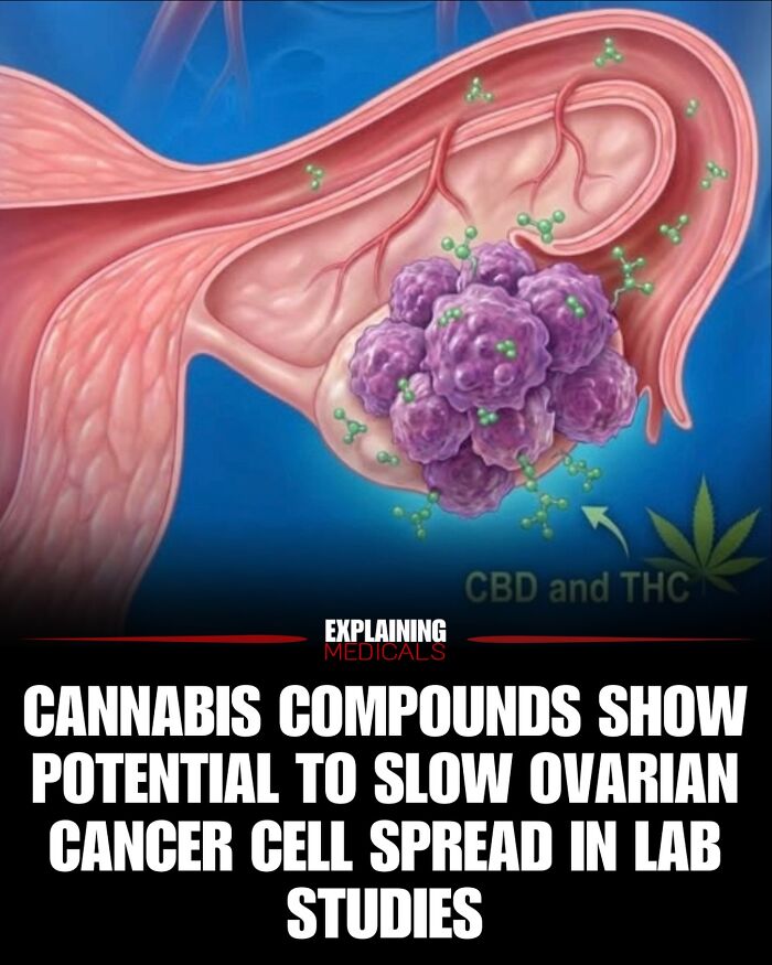 Cannabis compounds showing potential to slow ovarian cancer cell spread in lab studies