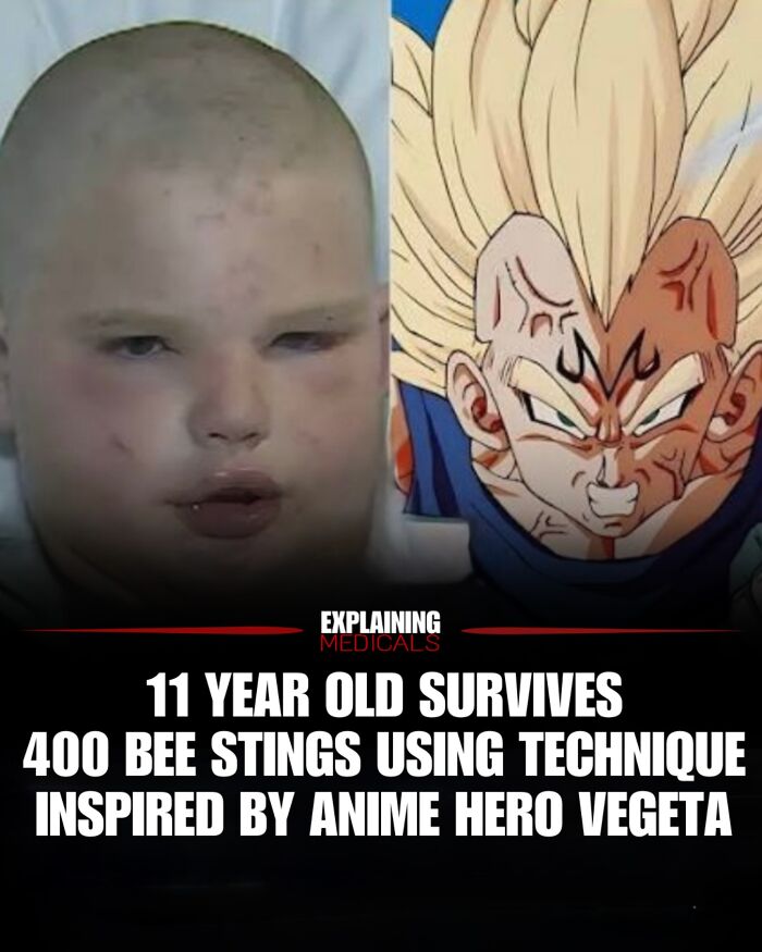 11 year old survives 400 bee stings using technique inspired by anime hero Vegeta.