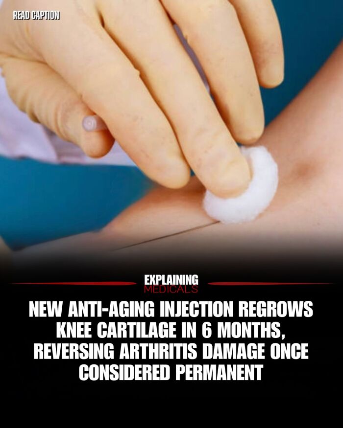 New anti-aging injection regrows knee cartilage and reverses arthritis damage in 6 months