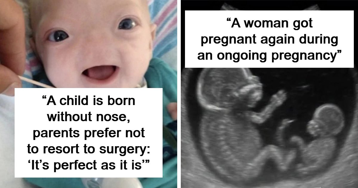 “The Patient Has 81 Teeth”: 61 Facts About Health And The Human Body That Show Just How Strange We Really Are