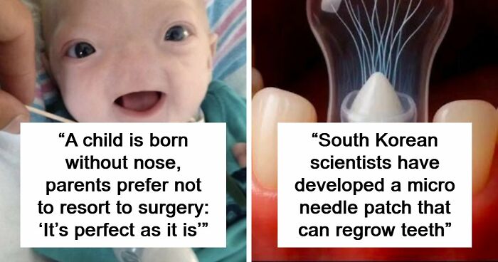 “The Patient Has 81 Teeth”: 61 Facts About Health And The Human Body That Show Just How Strange We Really Are