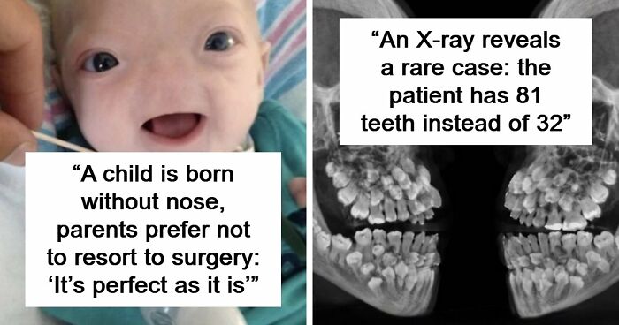 “The Patient Has 81 Teeth”: 61 Facts About Health And The Human Body That Show Just How Strange We Really Are