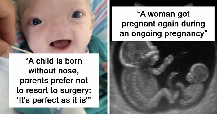 “The Patient Has 81 Teeth”: 61 Facts About Health And The Human Body That Show Just How Strange We Really Are