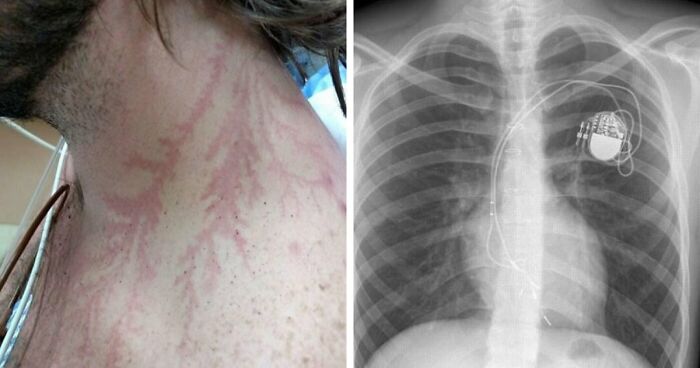 61 Interesting Photos Of Human Body Quirks That Are Both Fascinating And Shocking (New Pics)