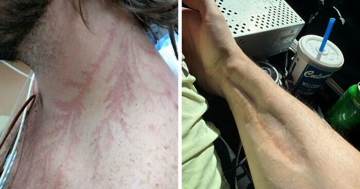 61 Interesting Photos Of Human Body Quirks That Are Both Fascinating And Shocking (New Pics)