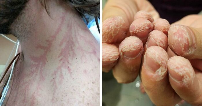 61 Interesting Photos Of Human Body Quirks That Are Both Fascinating And Shocking (New Pics)