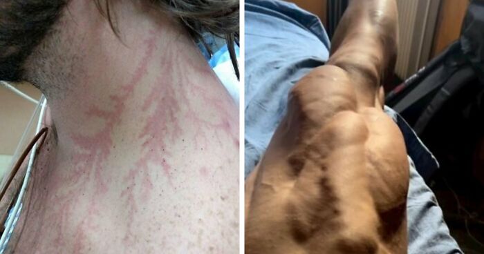 61 Interesting Photos Of Human Body Quirks That Are Both Fascinating And Shocking (New Pics)