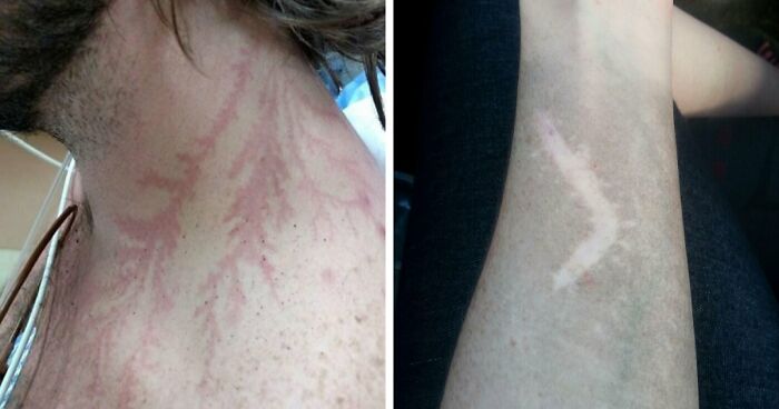 61 Interesting Photos Of Human Body Quirks That Are Both Fascinating And Shocking (New Pics)
