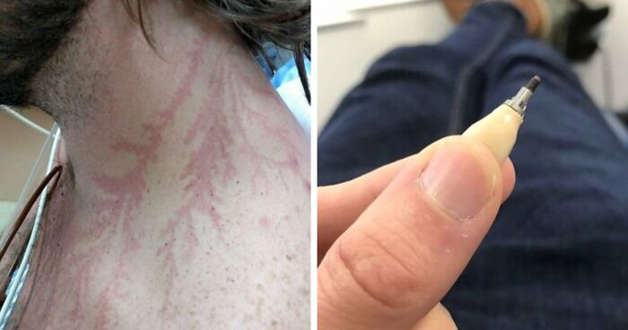 61 Interesting Photos Of Human Body Quirks That Are Both Fascinating And Shocking (New Pics)