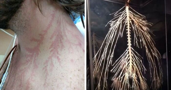 61 Interesting Photos Of Human Body Quirks That Are Both Fascinating And Shocking (New Pics)