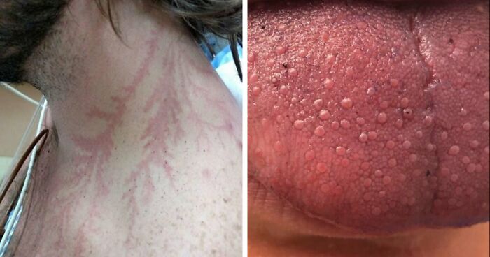 61 Interesting Photos Of Human Body Quirks That Are Both Fascinating And Shocking (New Pics)