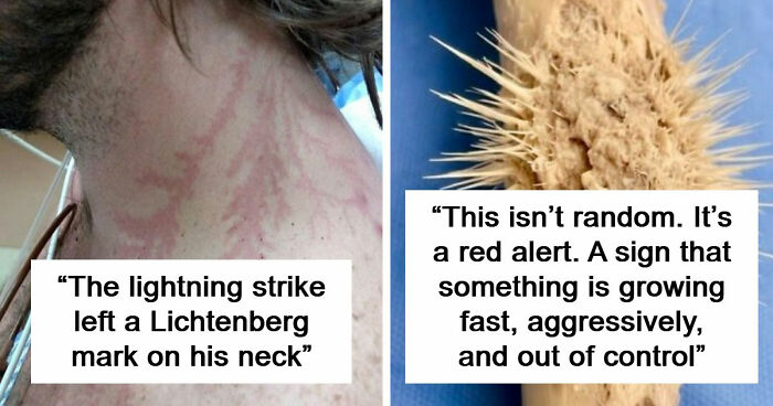 61 Interesting Photos Of Human Body Quirks That Are Both Fascinating And Shocking (New Pics)
