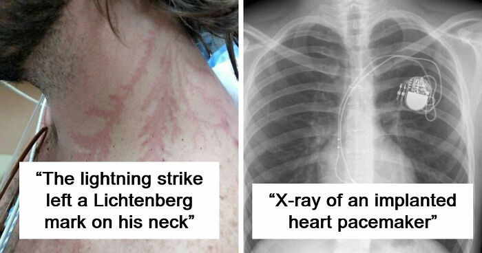 61 Interesting Photos Of Human Body Quirks That Are Both Fascinating And Shocking (New Pics)