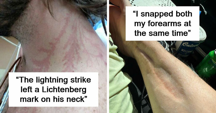 61 Interesting Photos Of Human Body Quirks That Are Both Fascinating And Shocking (New Pics)