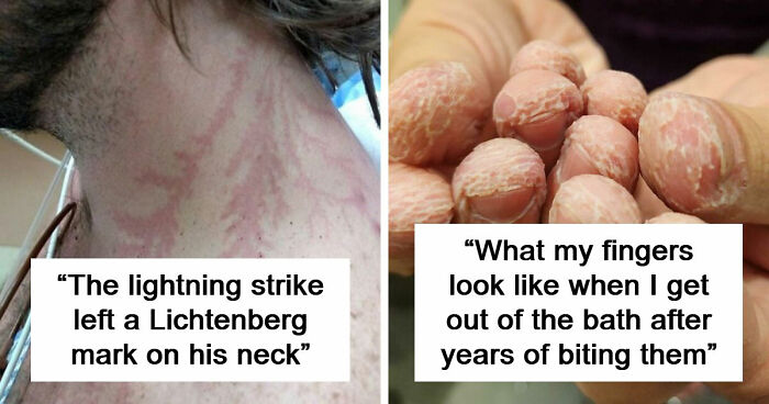 61 Interesting Photos Of Human Body Quirks That Are Both Fascinating And Shocking (New Pics)