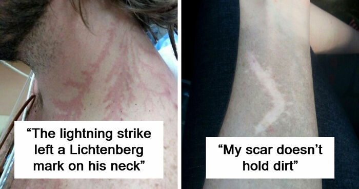61 Interesting Photos Of Human Body Quirks That Are Both Fascinating And Shocking (New Pics)