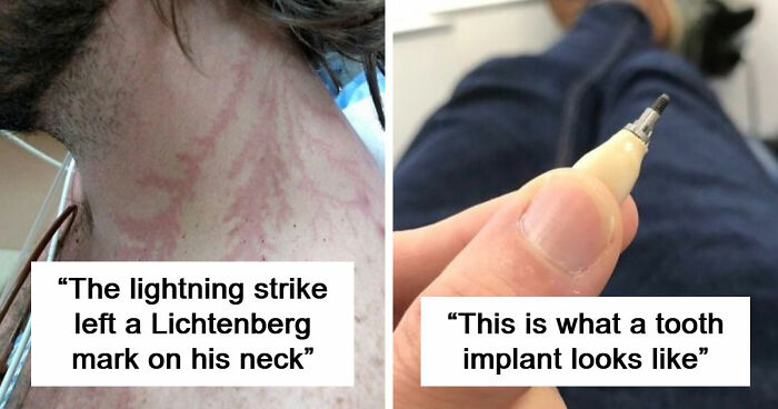 61 Interesting Photos Of Human Body Quirks That Are Both Fascinating And Shocking (New Pics)