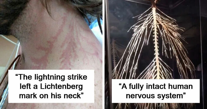 61 Interesting Photos Of Human Body Quirks That Are Both Fascinating And Shocking (New Pics)