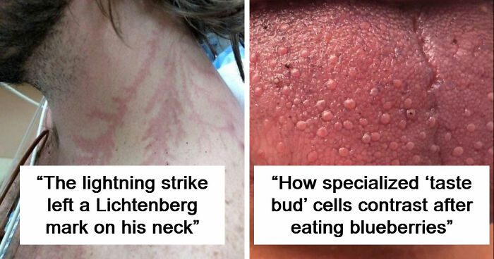 61 Interesting Photos Of Human Body Quirks That Are Both Fascinating And Shocking (New Pics)