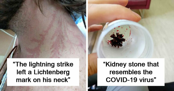 61 Interesting Photos Of Human Body Quirks That Are Both Fascinating And Shocking (New Pics)