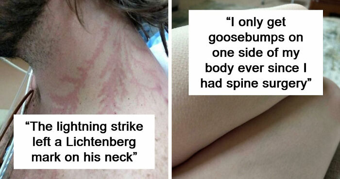 61 Interesting Photos Of Human Body Quirks That Are Both Fascinating And Shocking (New Pics)