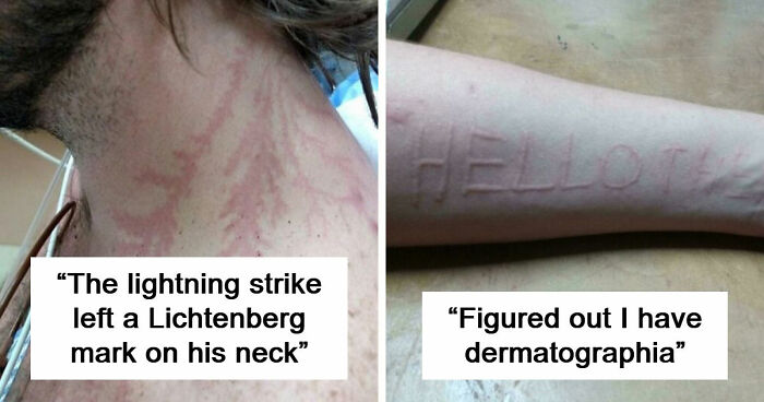 61 Interesting Photos Of Human Body Quirks That Are Both Fascinating And Shocking (New Pics)