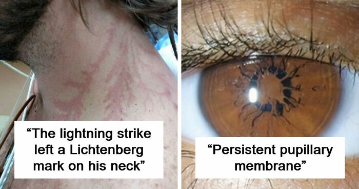 61 Interesting Photos Of Human Body Quirks That Are Both Fascinating And Shocking (New Pics)