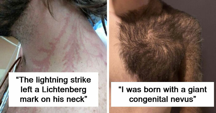 61 Interesting Photos Of Human Body Quirks That Are Both Fascinating And Shocking (New Pics)
