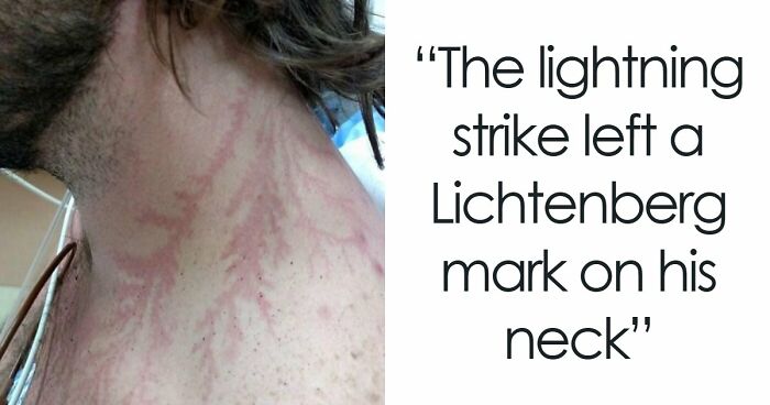 61 Interesting Photos Of Human Body Quirks That Are Both Fascinating And Shocking (New Pics)