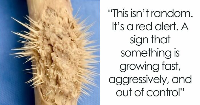 61 Interesting Photos Of Human Body Quirks That Are Both Fascinating And Shocking (New Pics)