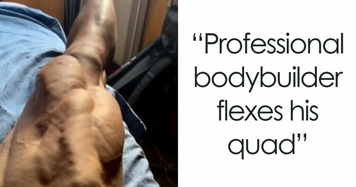 61 Interesting Photos Of Human Body Quirks That Are Both Fascinating And Shocking (New Pics)