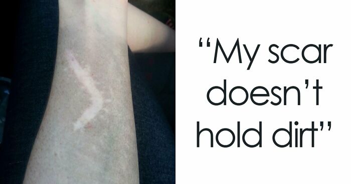 61 Interesting Photos Of Human Body Quirks That Are Both Fascinating And Shocking (New Pics)