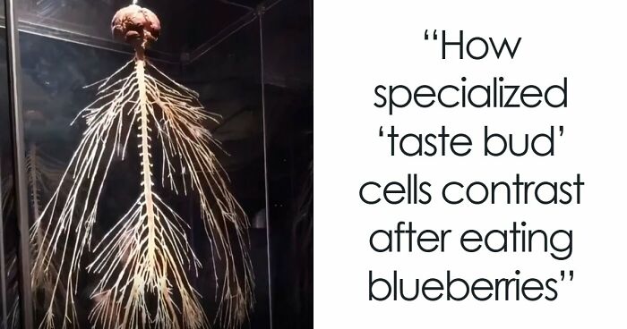 61 Interesting Photos Of Human Body Quirks That Are Both Fascinating And Shocking (New Pics)