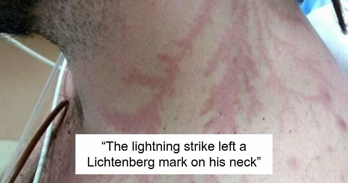 61 Interesting Photos Of Human Body Quirks That Are Both Fascinating And Shocking (New Pics)